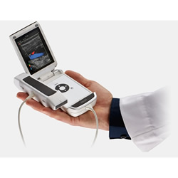 Hand Held Ultrasound V-Scan