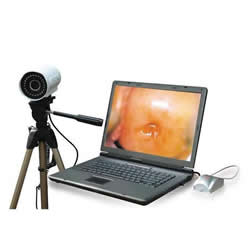 Digital video colposcope